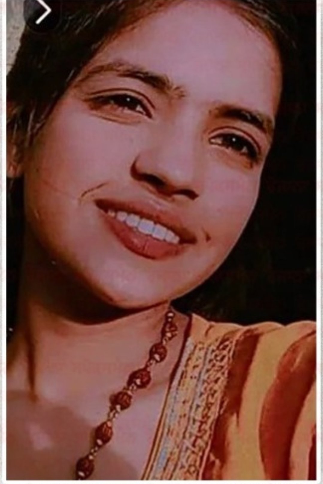 Sri Fatehgarh Sahib ; ਬੱਸੀ ਪਠਾਣਾ ‘ਚ ਪਰਿਵਾਰ ਨੇ ਕਾਈਮ ਕੀਤੀ ਮਿਸਾਲ, ਧੀ ਦੀ ਮੌਤ ਮਗਰੋਂ ਅੰਗ ਕੀਤੇ ਦਾਨ