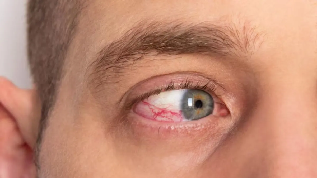 Health Update: ਬਲੱਡ ਕੈਂਸਰ ਤੋਂ ਲੈ ਕੇ ਅਲਜ਼ਾਈਮਰ ਤੱਕ, ਡਾਕਟਰ ਨੇ ਕਿਹਾ ਕਿ ਅੱਖਾਂ ਵੀ ਇਨ੍ਹਾਂ 7 ਖ਼ਤਰਨਾਕ ਬਿਮਾਰੀਆਂ ਦਾ ਦਿੰਦੀਆਂ ਸੰਕੇਤ