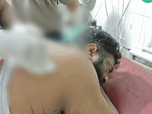 ਭਾਜਪਾ ਨੇਤਾ ਬਾਂਸਲ ‘ਤੇ ਤੇਜ਼ਧਾਰ ਹਥਿਆਰ ਨਾਲ ਹਮਲਾ, ਹੋਏ ਗੰਭੀਰ ਜਖਮੀ