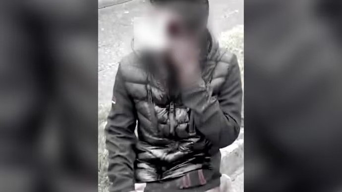 काम की तलाश में आयरलैंड पहुंचे भारतीय युवक पर हमला, बुरी तरह घायल, एक्शन में भारत