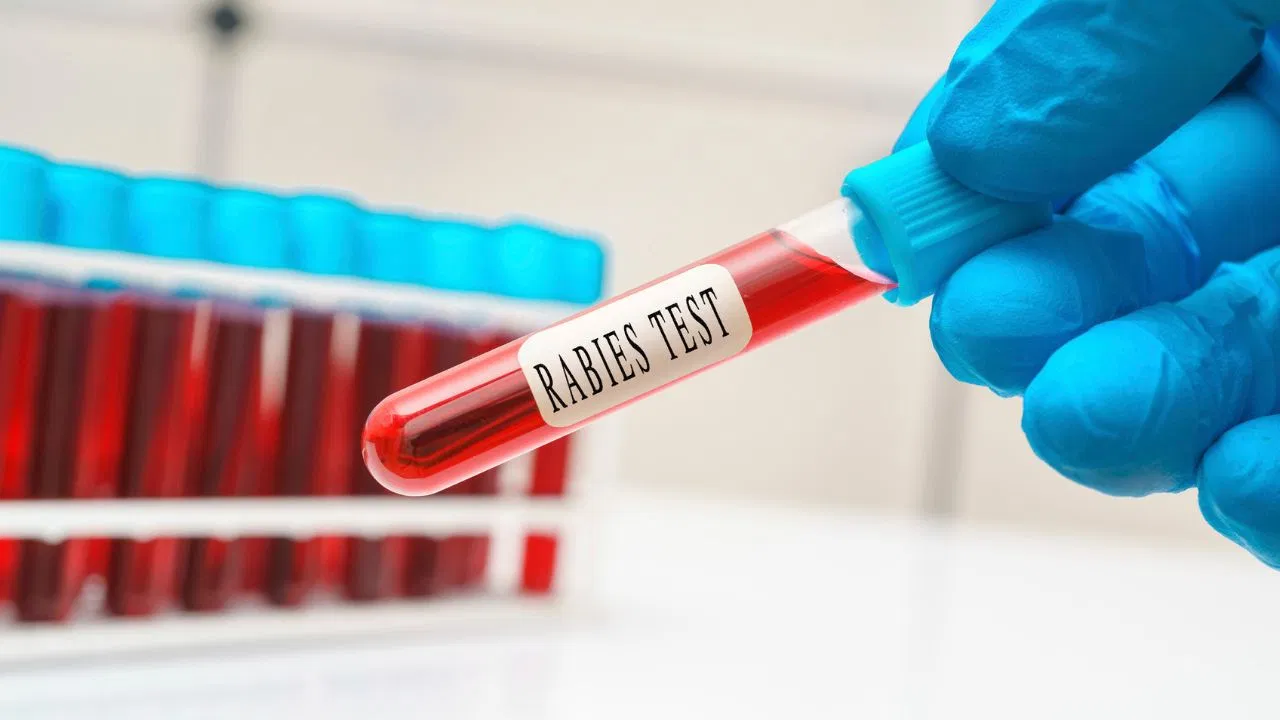 Health Tip: भारत में हर साल 5700 लोग गंवाते हैं अपनी जान, 2030 तक भारत को रेबीज मुक्त बनाने का लक्ष्य…..