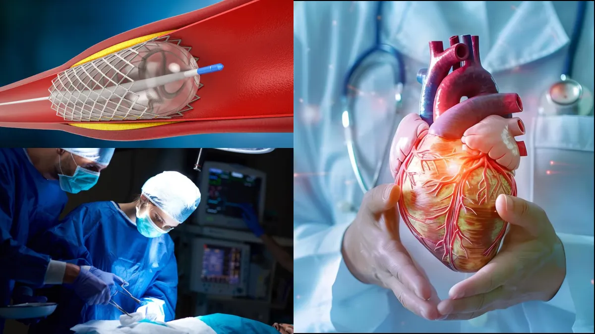 Bypass Surgery ਕਰਵਾਉਣ ਵਾਲੇ ਜਰੂਰ ਦੇਖਣ ਇਹ ਵੀਡੀਓ…, ਤੁਹਾਨੂੰ ਕਿਤੇ ਨਹੀਂ ਮਿਲਣੀ ਇਹ ਜਾਣਕਾਰੀ