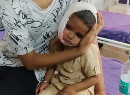 Punjab: ਢਾਈ ਸਾਲ ਦੇ ਬੱਚੇ ‘ਤੇ ਕੁੱਤੇ ਦਾ ਹਮਲਾ, ਚਿਹਰੇ ‘ਤੇ 9 ਟਾਂਕੇ, ਪੀਜੀਆਈ ਚੰਡੀਗੜ੍ਹ ‘ਚ ਇਲਾਜ ਅਧੀਨ Punjab: ਢਾਈ ਸਾਲ ਦੇ ਬੱਚੇ ‘ਤੇ ਕੁੱਤੇ ਦਾ ਹਮਲਾ, ਚਿਹਰੇ ‘ਤੇ 9 ਟਾਂਕੇ, ਪੀਜੀਆਈ ਚੰਡੀਗੜ੍ਹ ‘ਚ ਇਲਾਜ ਅਧੀਨ