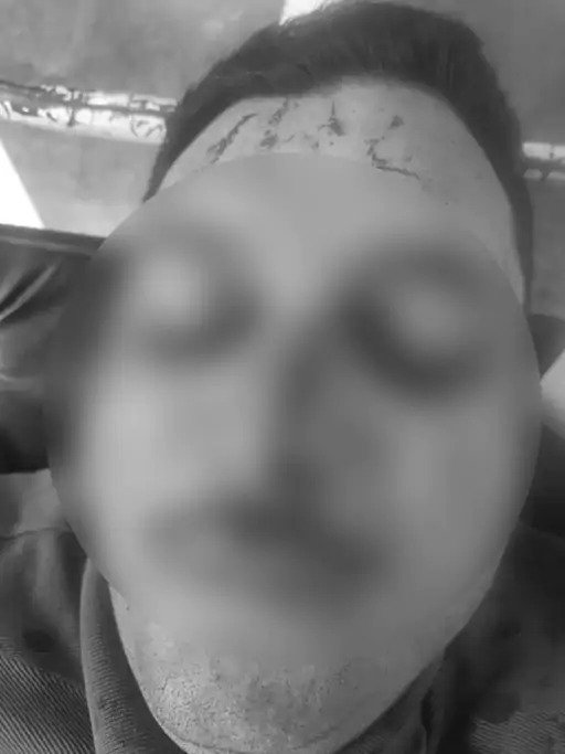 ਚੰਡੀਗੜ੍ਹ ‘ਚ ਹੈੱਡ ਕਾਂਸਟੇਬਲ ‘ਤੇ ਹਮਲਾ ਕਰਕੇ ਵੱਢਿਆ ਨੱਕ, ਨਕਦੀ ਅਤੇ ਚੇਨ ਲੁੱਟੀ