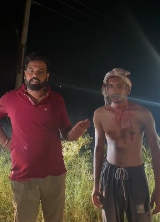 ਹਮਲਾਵਰਾਂ ਨੇ ਨੌਜਵਾਨ ‘ਤੇ ਕੀਤਾ ਤੇਜ਼ਧਾਰ ਹਥਿਆਰਾਂ ਨਾਲ ਹਮਲਾ, ਗੰਭੀਰ ਰੂਪ ‘ਚ ਕੀਤਾ ਜ਼ਖਮੀ