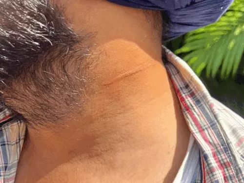 ਚਾਈਨਾ ਡੋਰ ਨਾਲ ਨੌਜਵਾਨ ਦੀ ਗਰਦਨ ਤੇ ਉਂਗਲਾਂ 'ਤੇ ਲੱਗੇ ਕਟ, ਵਾਲ-ਵਾਲ ਬਚੀ ਜਾਨ