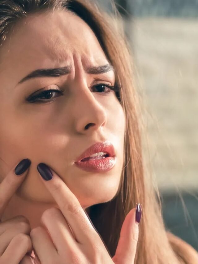 ਕਿਸ ਵਿਟਾਮਿਨ ਦੀ ਕਮੀ ਨਾਲ ਹੁੰਦੇ ਹਨ skin ਤੇ pimples...