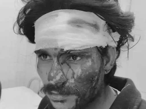 ਅਬੋਹਰ ਵਿੱਚ ਨੌਜਵਾਨ ‘ਤੇ ਤਲਵਾਰ ਨਾਲ ਹਮਲਾ