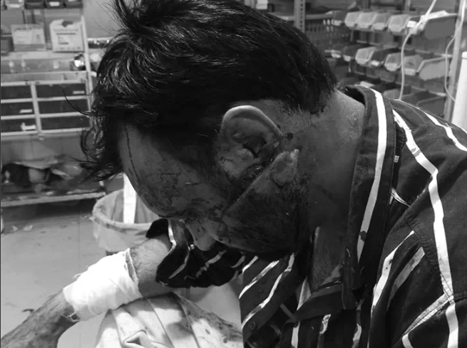 ਲੁਧਿਆਣਾ ਵਿੱਚ ਘਰ ਵਿੱਚ ਦਾਖਲ ਹੋ ਕੇ ਭਰਾਵਾਂ ‘ਤੇ ਕਿਰਪਾਨ ਨਾਲ ਜਾਨਲੇਵਾ ਹਮਲਾ