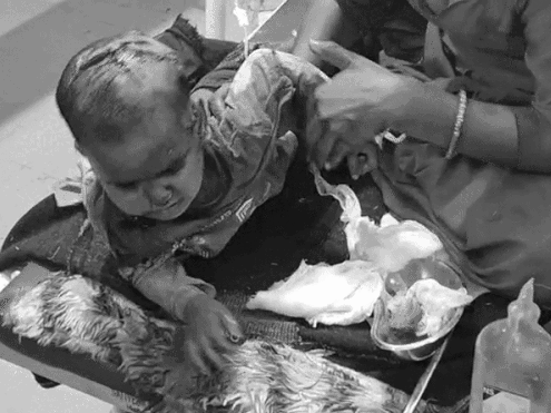 ਆਵਾਰਾ ਕੁੱਤਿਆਂ ਦਾ ਵੱਧਿਆ ਕਹਿਰ ,ਗਲੀ ਵਿਚ ਖੇਡ ਰਹੀ ਬੱਚੀ ‘ਤੇ ਜਾਨਲੇਵਾ ਹਮਲਾ