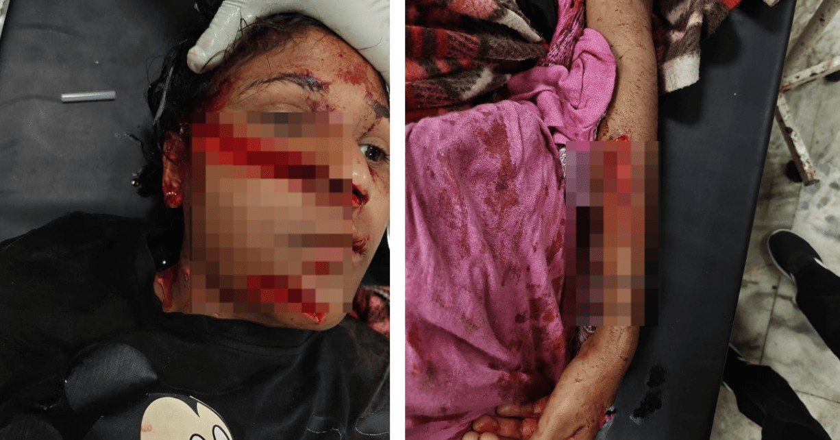 ਰਿਸ਼ਤੇ ਹੋਏ ਸ਼ਰਮਸ਼ਾਰ! ਨਾਨੇ ਨੇ ਦੋਹਤੀ ਨਾਲ ਕੀਤੀ ਗੰਦੀ ਕਰਤੂਤ, ਵਿਰੋਧ ‘ਤੇ ਦਾਤਰ ਨਾਲ ਕੀਤਾ ਵਾਰ