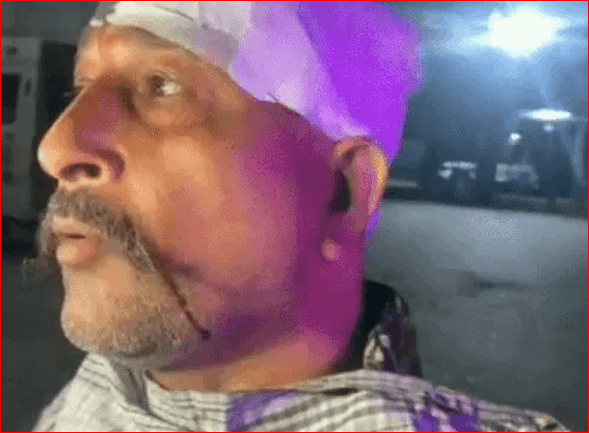 ਜਲੰਧਰ ਵਿੱਚ ਦੋ ਪਰਿਵਾਰਾਂ ਵਿਚਕਾਰ ਝੜਪ, ਪੈਸੇ ਦੇ ਲੈਣ-ਦੇਣ ਨੂੰ ਲੈ ਕੇ ਵਿਵਾਦ