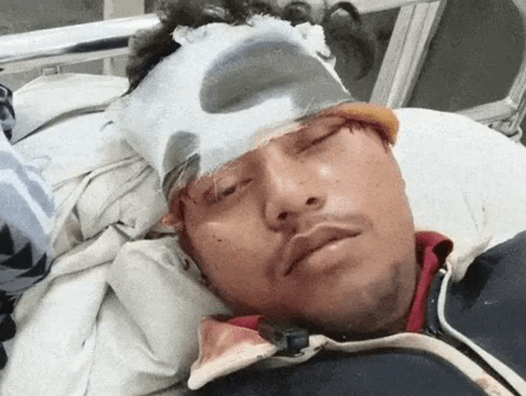 ਹੁਸ਼ਿਆਰਪੁਰ ਵਿੱਚ ਧੂੰਏਂ ਕਾਰਨ ਭਿਆਨਕ ਸੜਕ ਹਾਦਸਾ: 1 ਦੀ ਮੌਤ, 3 ਗੰਭੀਰ ਜ਼ਖਮੀ