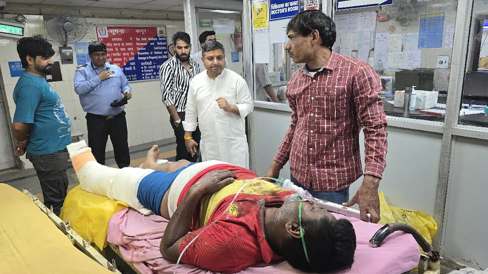 ਦਿੱਲੀ ‘ਚ CNG ਭਰਦੇ ਸਮੇਂ ਧਮਾਕਾ, ਦਵਾਰਕਾ ‘ਚ ਟਰੱਕ ਸਿਲੰਡਰ ਫਟਣ ਨਾਲ 4 ਜਣੇ ਝੁਲਸੇ, ਇੱਕ ਗੰਭੀਰ