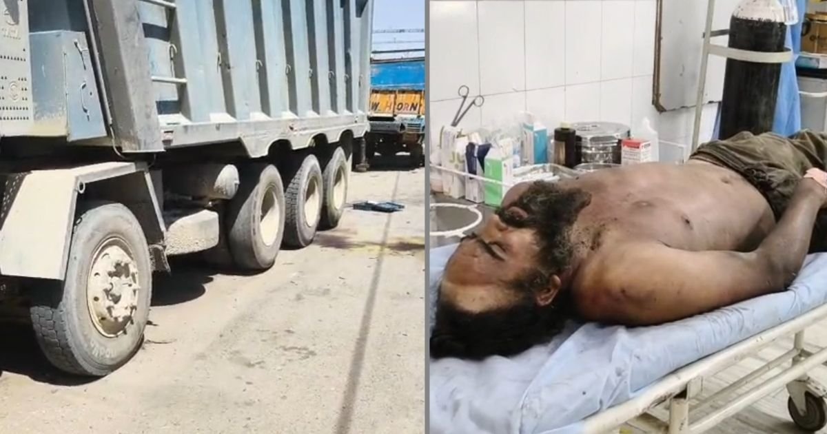 ਇੱਕ ਲਾਪਰਵਾਹੀ ਕਰਕੇ ਵਾਪਰਿਆ ਵੱਡਾ ਹਾਦਸਾ, ਵਾਹਨ ਮਕੈਨਿਕ ਨੂੰ ਲੱਗਿਆ ਜ਼ੋਰਦਾਰ ਕਰੰਟ ਦਾ ਝਟਕਾ