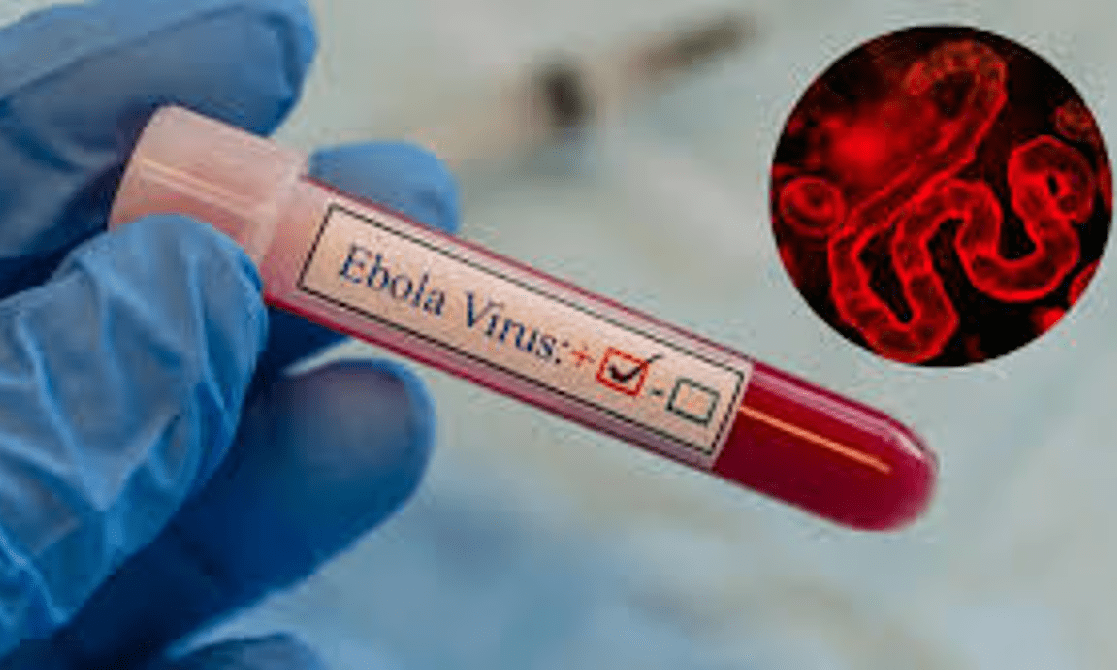 Ebola Virus ਨੂੰ ਲੈ ਕੇ ਭਾਰਤ ਵਿੱਚ ਹਾਈ ਅਲਰਟ: ਹਵਾਈ ਅੱਡਿਆਂ ਤੇ ਸਕ੍ਰੀਨਿੰਗ ਸਖ਼ਤ; ਅਫ਼ਰੀਕੀ ਦੇਸ਼ਾਂ ਤੋਂ ਆਉਣ ਵਾਲੇ ਮੁਸਾਫ਼ਰਾਂ ਲਈ Self-Declaration ਲਾਜ਼ਮੀ